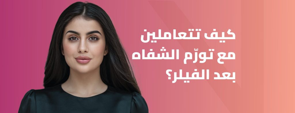 تورم الشفايف بعد الفيلر